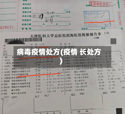 病毒疫情处方(疫情 长处方)-第2张图片