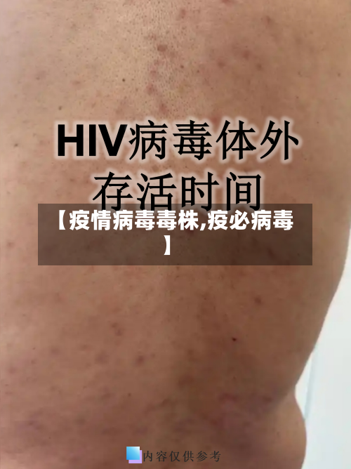 【疫情病毒毒株,疫必病毒】