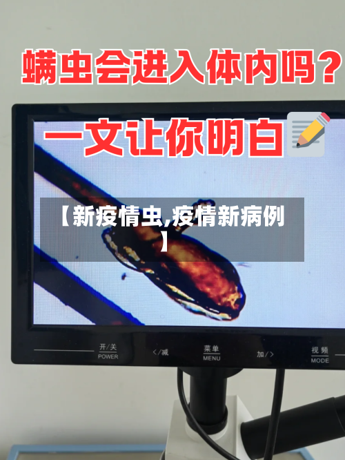 【新疫情虫,疫情新病例】-第2张图片