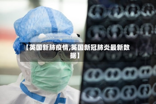 【英国新肺疫情,英国新冠肺炎最新数据】-第2张图片