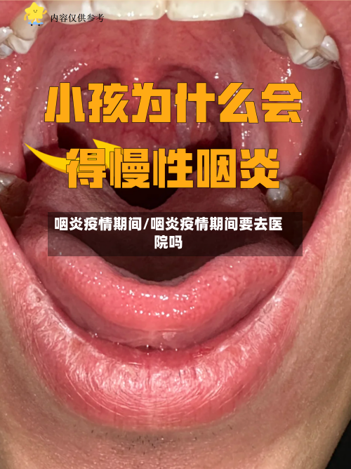 咽炎疫情期间/咽炎疫情期间要去医院吗