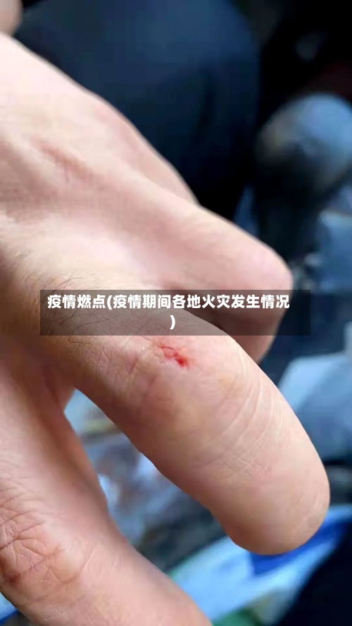 疫情燃点(疫情期间各地火灾发生情况)-第2张图片