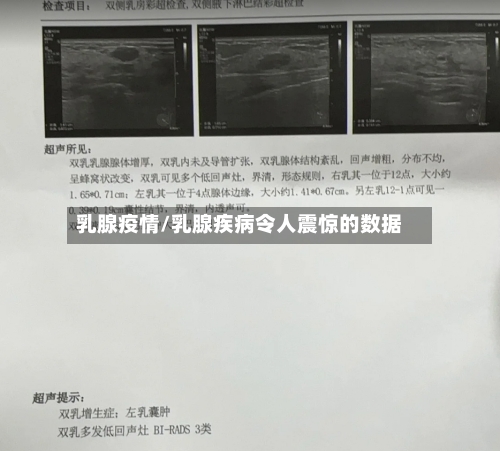 乳腺疫情/乳腺疾病令人震惊的数据-第2张图片