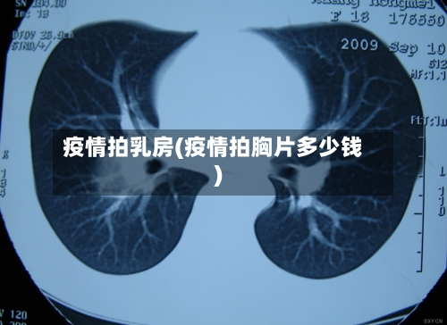 疫情拍乳房(疫情拍胸片多少钱)-第2张图片