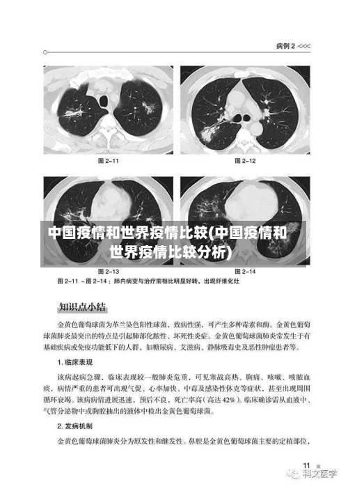 中国疫情和世界疫情比较(中国疫情和世界疫情比较分析)