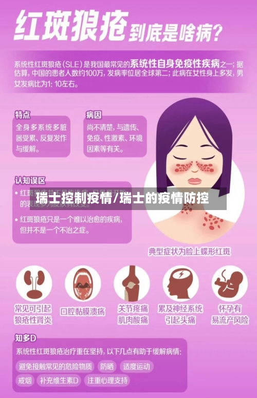 瑞士控制疫情/瑞士的疫情防控-第2张图片