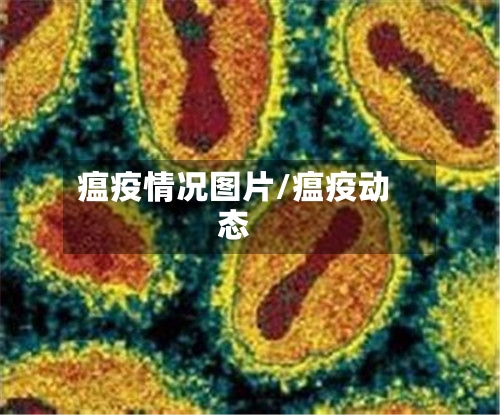 瘟疫情况图片/瘟疫动态-第2张图片
