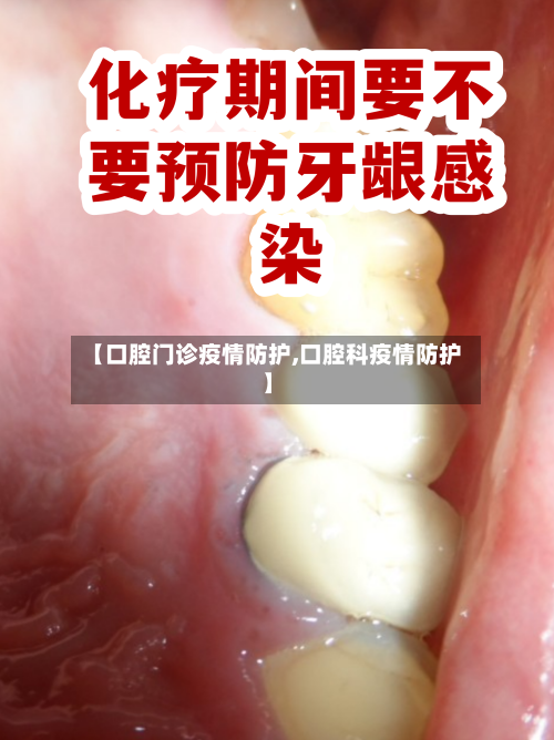 【口腔门诊疫情防护,口腔科疫情防护】-第3张图片