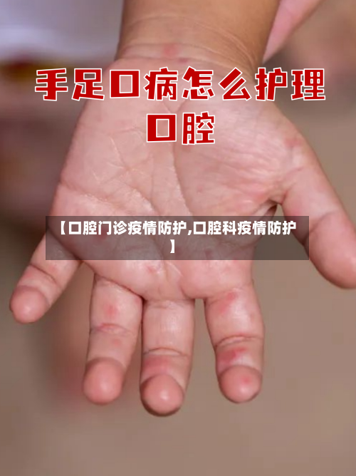 【口腔门诊疫情防护,口腔科疫情防护】-第2张图片