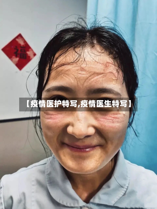 【疫情医护特写,疫情医生特写】-第3张图片