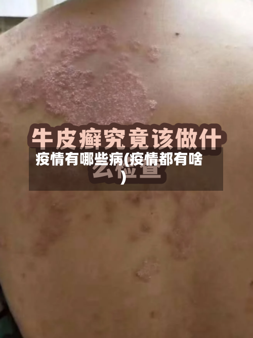 疫情有哪些病(疫情都有啥)-第3张图片