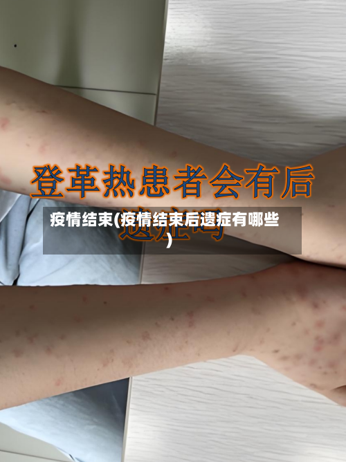 疫情结束(疫情结束后遗症有哪些)-第2张图片