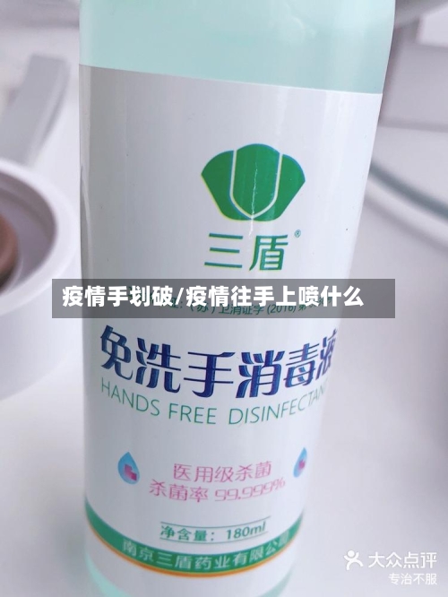 疫情手划破/疫情往手上喷什么-第3张图片