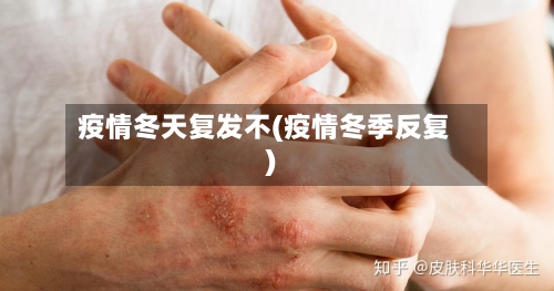 疫情冬天复发不(疫情冬季反复)-第2张图片