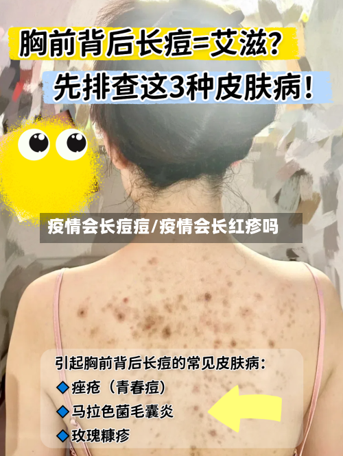 疫情会长痘痘/疫情会长红疹吗