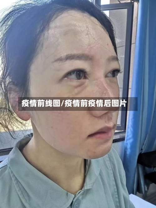 疫情前线图/疫情前疫情后图片