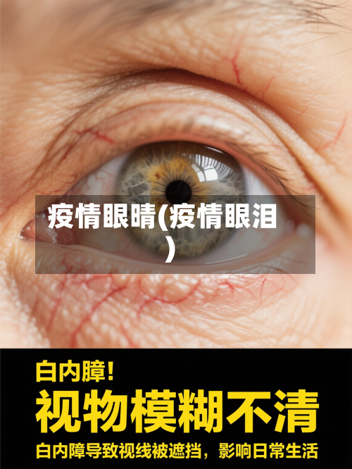 疫情眼晴(疫情眼泪)-第3张图片