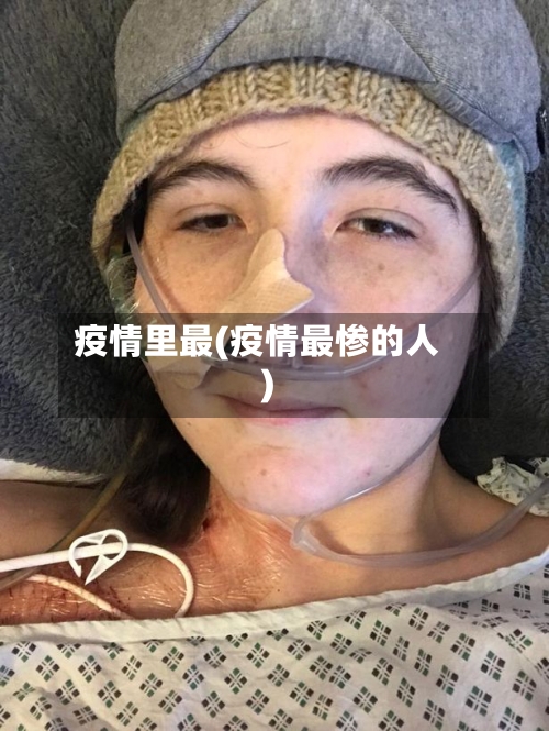 疫情里最(疫情最惨的人)-第2张图片