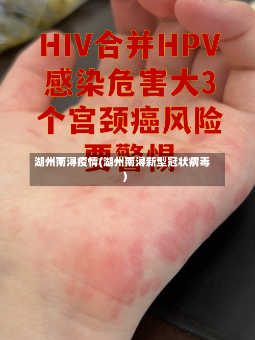 湖州南浔疫情(湖州南浔新型冠状病毒)