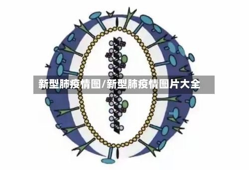 新型肺疫情图/新型肺疫情图片大全-第2张图片