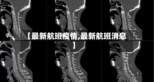 【最新航班疫情,最新航班消息】