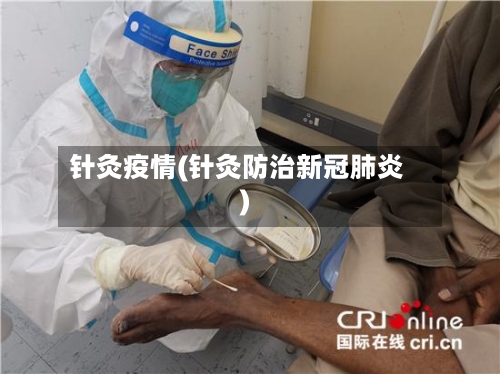 针灸疫情(针灸防治新冠肺炎)-第2张图片