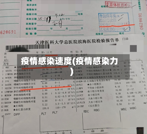 疫情感染速度(疫情感染力)-第3张图片