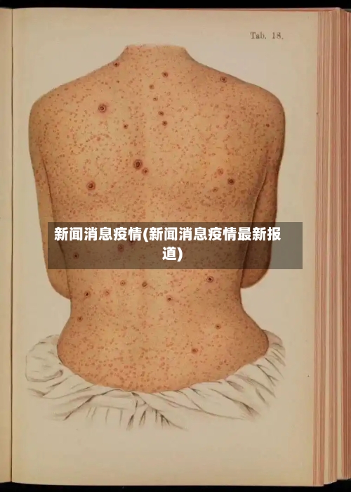 新闻消息疫情(新闻消息疫情最新报道)