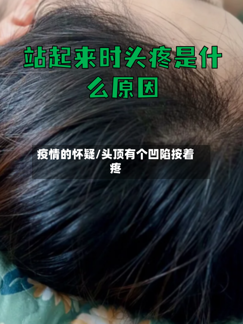 疫情的怀疑/头顶有个凹陷按着疼-第2张图片