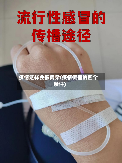 疫情这样会被传染(疫情传播的四个条件)