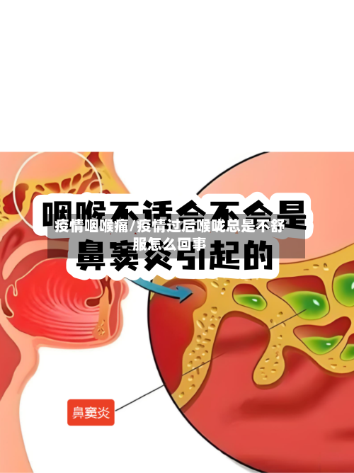 疫情咽喉痛/疫情过后喉咙总是不舒服怎么回事-第3张图片