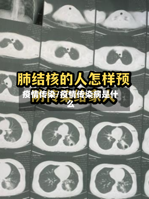 疫情传染/疫情传染病是什么-第2张图片