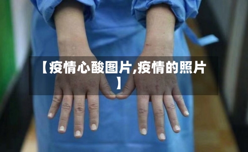 【疫情心酸图片,疫情的照片】-第2张图片